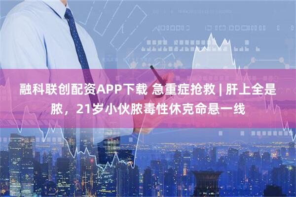 融科联创配资APP下载 急重症抢救 | 肝上全是脓，21岁小伙脓毒性休克命悬一线